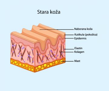 Stara koža